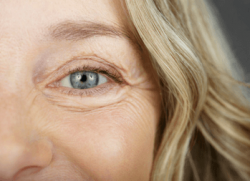 Close up of a smiling lady for eye treatments