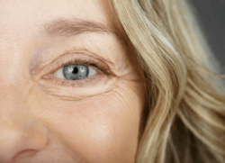 Close up of a smiling lady for anti-ageing eye treatments in Inverness