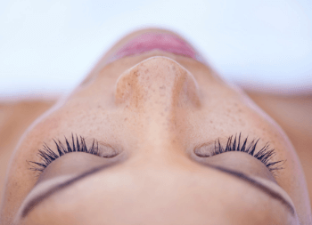 chemical peel treatment process for anti-ageing treatment in Inverness