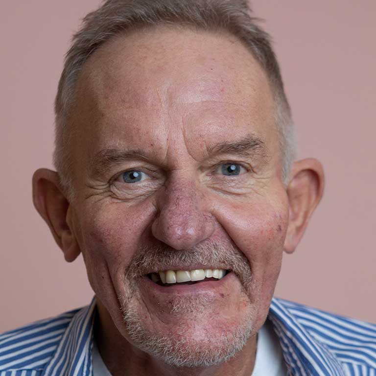 Dermal Fillers Inverness Loss of Volume Emma J Aesthetics