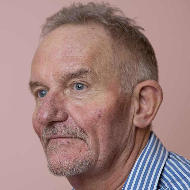 Dermal Fillers Inverness Loss of Volume Emma J Aesthetics