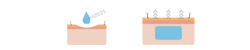 dermal fillers how they work in Inverness